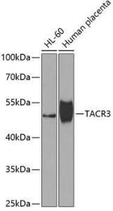 Western blot analysis of extracts of various cell lines, using Anti-Neurokinin B Receptor Antibody (A10086) at 1:1,000 dilution The secondary antibody was Goat Anti-Rabbit IgG H&L Antibody (HRP) at 1:10,000 dilution Lysates/proteins were present at 25 µg per lane