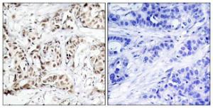 Antibody anti-SAPK phospho THR183 100 µg