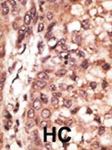 Anti-CREB3L1 Rabbit Polyclonal Antibody