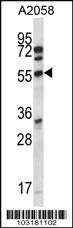 Anti-CDK15 Rabbit Polyclonal Antibody