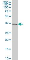 Anti-CXCR4 Mouse Monoclonal Antibody [clone: 2A9]