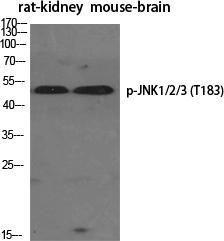 Antibody anti-SAPK phospho THR183 100 µg