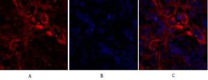 Immunofluorescence analysis of human lung cancer tissue using Anti-Ki67 Antibody (red) at 1:200 (4°C overnight). Cy3 labelled secondary antibody was used at 1:300 (RT 50min). Panel A: Target. Panel B: DAPI. Panel C: Merge.