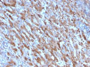 Immunohistochemical analysis of formalin-fixed, paraffin-embedded human liver using Anti-C1QA Antibody [C1QA/2954]