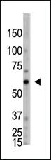 Anti-OASL Rabbit Polyclonal Antibody