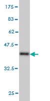 Anti-RPL13 Mouse Monoclonal Antibody [clone: 3F6]