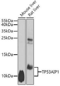 Anti-p53 AIP1 Rabbit Polyclonal Antibody