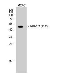 Antibody anti-SAPK phospho THR183 100 µg