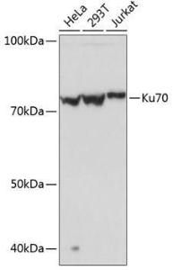 Anti-Ku70 Rabbit Monoclonal Antibody [clone: ARC0551]