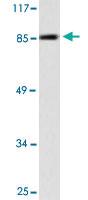 Anti-PGR Rabbit Polyclonal Antibody