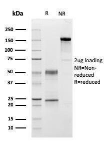 SDS-PAGE analysis of Anti-C1QA Antibody [C1QA/2954] under non-reduced and reduced conditions; showing intact IgG and intact heavy and light chains, respectively. SDS-PAGE analysis confirms the integrity and purity of the antibody