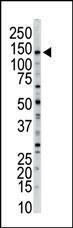 Anti-Myosin Light Chain Kinase, Smooth Muscle Rabbit Polyclonal Antibody (FITC (Fluorescein))