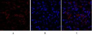 Immunofluorescence analysis of human breast cancer tissue using Anti-Ki67 Antibody (red) at 1:200 (4°C overnight). Cy3 labelled secondary antibody was used at 1:300 (RT 50min). Panel A: Target. Panel B: DAPI. Panel C: Merge.