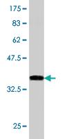 Anti-SRSF10 Mouse Monoclonal Antibody [clone: 1G11]