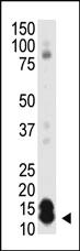 Anti-SUMO1 Rabbit Polyclonal Antibody