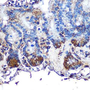 Antibody anti-ITLN1 100 µl