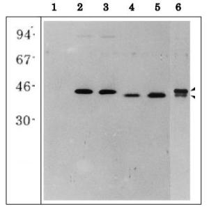 Anti-Glutamine Synthetase Antibody