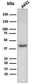 Western blot analysis of A431 cell line lysate using Anti-Filaggrin Antibody [FLG/3909R]