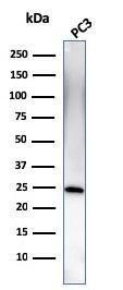 Western blot analysis of human PC3 cell lysate using Anti-C1QA Antibody [C1QA/2954]