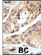 Anti-SUMO1 Rabbit Polyclonal Antibody