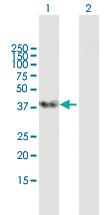 Anti-SRSF5 Mouse Polyclonal Antibody