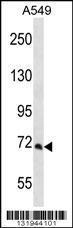 Anti-PCCA Rabbit Polyclonal Antibody