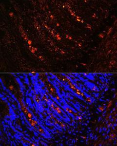 Antibody anti-ITLN1 100 µl