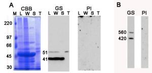 Anti-Glutamine Synthetase Antibody