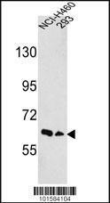 Anti-EPHA3 Rabbit Polyclonal Antibody