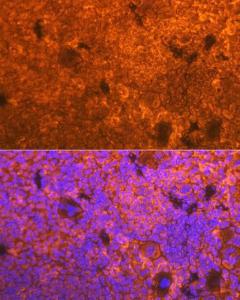 Immunofluorescence analysis of mouse spleen using Anti-CD3D Antibody [ARC1741] (A308414) at a dilution of 1:100 (40X lens). DAPI was used to stain the cell nuclei (blue)