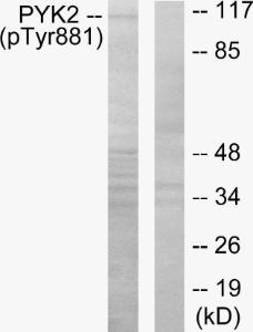 Antibody anti-PYK2 phospho TYR881 100 µg