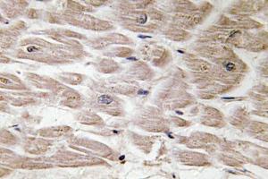 Immunohistochemical analysis of paraffin-embedded human heart tissue using Anti-Defensin alpha4 Antibody