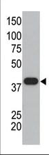 Anti-SUMO1 Rabbit Polyclonal Antibody