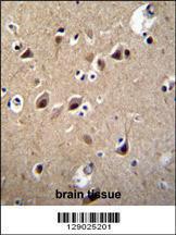 Anti-LRTM2 Rabbit Polyclonal Antibody (Biotin)