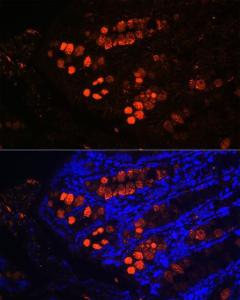 Antibody anti-ITLN1 100 µl