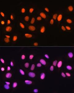 Anti-Ku70 Rabbit Monoclonal Antibody [clone: ARC0551]