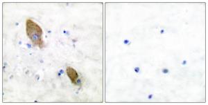 Antibody anti-PYK2 phospho TYR881 100 µg