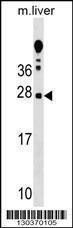 Anti-TRAT1 Rabbit Polyclonal Antibody (FITC (Fluorescein Isothiocyanate))