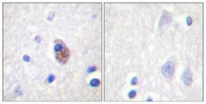 Antibody anti-PYK2 phospho TYR881 100 µg