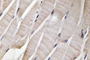 Immunohistochemical analysis of paraffin-embedded human skeletal muscle tissue using Anti-Defensin alpha3 Antibody