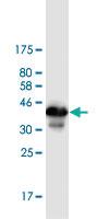 Anti-ZBTB6 Mouse Monoclonal Antibody [clone: 2E12]