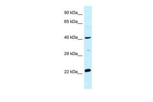 Anti-CCDC68 Rabbit Polyclonal Antibody