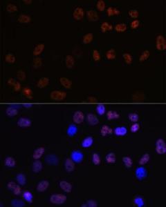 Immunofluorescence analysis of HeLa cells using Anti-MCM7/PRL Antibody [ARC0573] (A80798) at a dilution of 1:100 (40X lens). DAPI was used to stain the cell nuclei (blue)