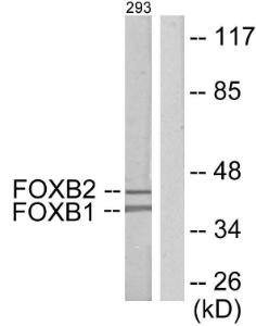 Western blot analysis of lysates from 293 cells using Anti-FOXB1 + FOXB2 Antibody. The right hand lane represents a negative control, where the antibody is blocked by the immunising peptide