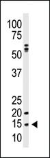 Anti-SUMO1 Rabbit Polyclonal Antibody