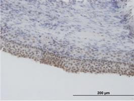 Anti-SRSF5 Mouse Polyclonal Antibody