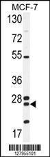 Anti-NUDT8 Rabbit Polyclonal Antibody (Biotin)