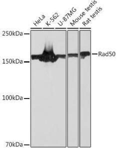 Western blot analysis of extracts of various cell lines, using Anti-Rad50 Antibody [ARC0854] (A308415) at 1:1,000 dilution. The secondary antibody was Goat Anti-Rabbit IgG H&L Antibody (HRP) at 1:10,000 dilution.