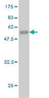 Anti-PCMT1 Mouse Monoclonal Antibody [clone: 4G9]