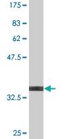 Anti-ESR1 Mouse Monoclonal Antibody [clone: 2F8]